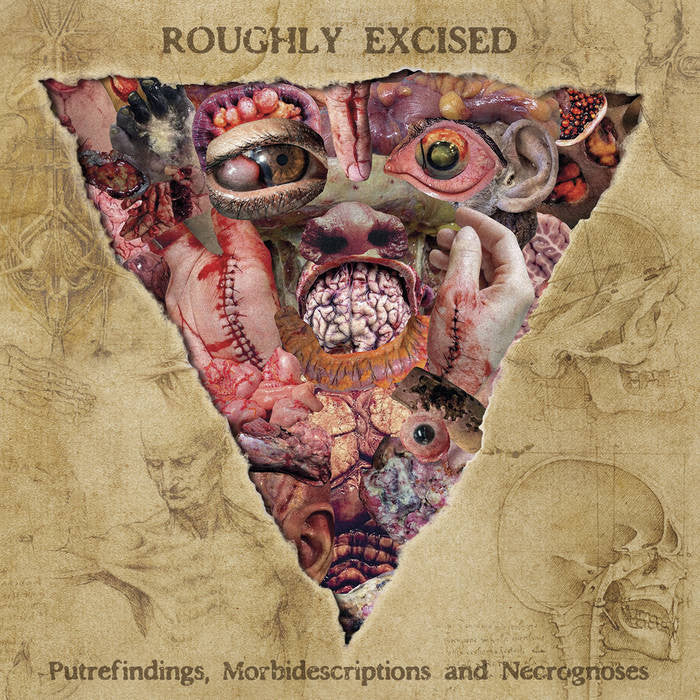 LYMPHATIC PHLEGM - Roughly Excised - Putrefindings, Morbidescriptions and... CD | Black Hearts Records