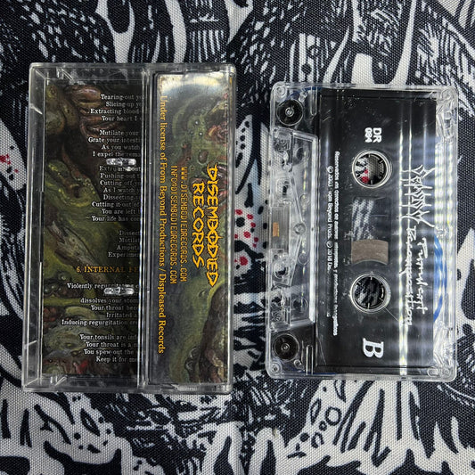 Sepsism - Purulent Decomposition Cassete